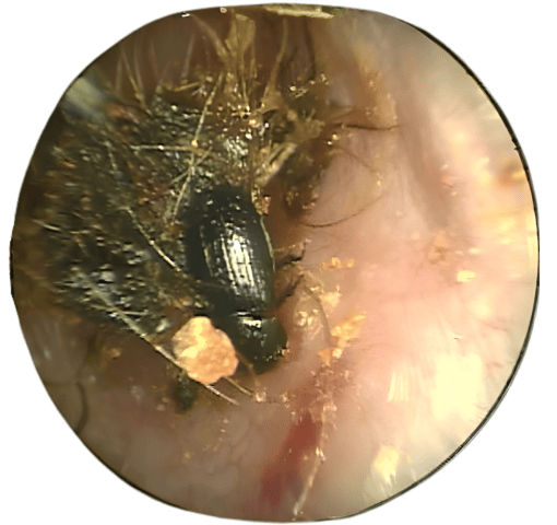 Close-up of an insect inside an ear canal with hair and debris.