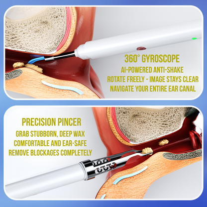 Slivor VisioEar: Doctor Approved Ear Health Technology